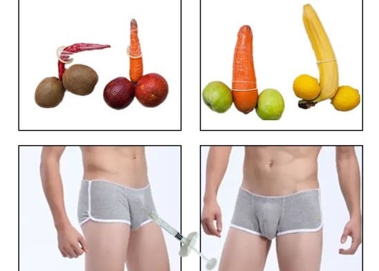 음경 확대 빈 외과적 피부 필러 음경 확대 주입