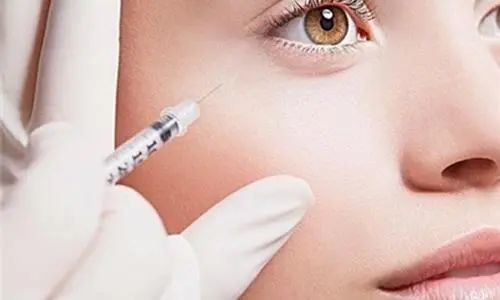 히알루론산 입술 젤 주사 눈 주름 합성 히알루론산 피부 필러