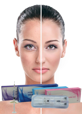 전문 주름 필러 24mg/Ml Hyaluronic Acid For Face Cross Linked Sodium Hyaluronate 주사용