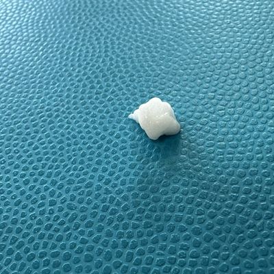 히알루론산 젤 칼슘 하이드록시라파티트 필러 주입 턱 증강 및 턱선 정의