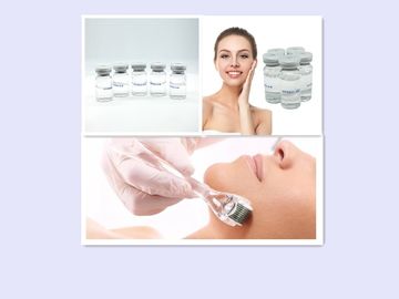 성형 수술 비 십자가는 입술 충전물의 주위에 HA 피부 충전물 5ml 주름을 연결했습니다