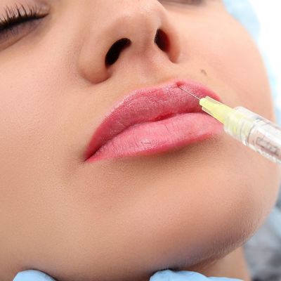 겔 형상 주사 가능한 Lip 충전기 24 마그네슘 / Ml 히알루론산 적격자