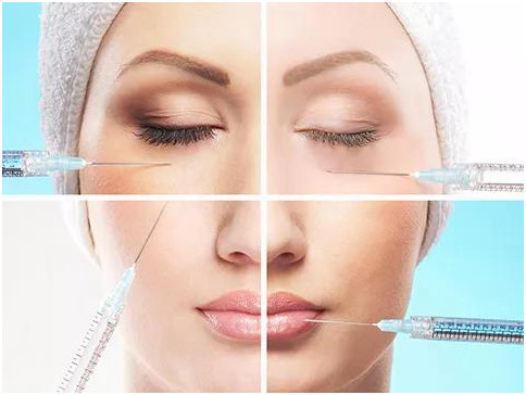 전문 주름 필러 24mg/Ml Hyaluronic Acid For Face Cross Linked Sodium Hyaluronate 주사용