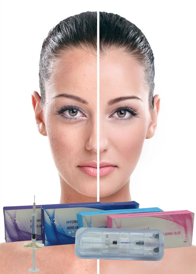 전문 주름 필러 24mg/Ml Hyaluronic Acid For Face Cross Linked Sodium Hyaluronate 주사용
